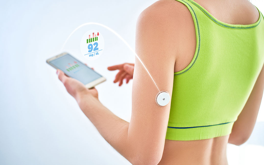 Benefits of Continuous Glucose Monitoring